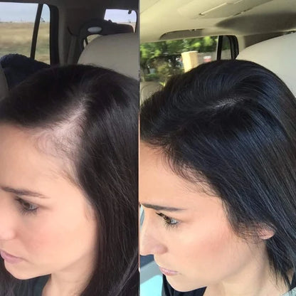 Cápsulas Crecimiento de Cabello